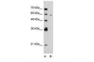 Image no. 3 for anti-Receptor-Interacting serine-threonine Kinase 3 (RIPK3) (AA 168-217) antibody (ABIN203367) (RIPK3 抗体  (AA 168-217))