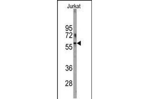 Western blot analysis of anti-PFKFB1 Antibody in Jurkat cell line lysates (35ug/lane). (PFKFB1 抗体  (N-Term))