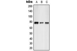 Western blot analysis of ATF6B expression in HepG2 (A), mouse liver (B), rat liver (C) whole cell lysates.