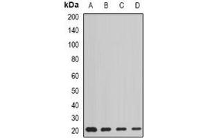 Western blot analysis of AGR2 expression in HT29 (A), MCF7 (B), mouse liver (C), rat lung (D) whole cell lysates. (AGR2 抗体)