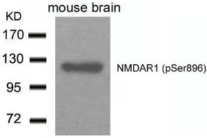 Western blot analysis of extracts from Mouse Brain tissue using NMDAR1(Phospho-Ser896) Antibody. (GRIN1/NMDAR1 抗体  (pSer896))