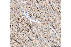 IHC analysis of Alpha Internexin using anti-Alpha Internexin antibody (ABIN4886634).