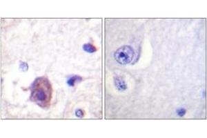 Immunohistochemistry analysis of paraffin-embedded human brain, using FAK (Phospho-Ser910) Antibody. (FAK 抗体  (pSer910))