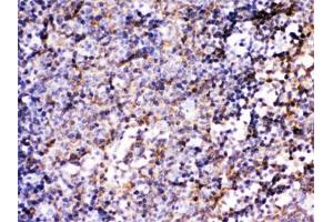 IHC testing of FFPE mouse lymph node with BCAR3 antibody. (BCAR3 抗体)