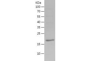 Estrogen Receptor alpha Protein (AA 2-170) (His tag)