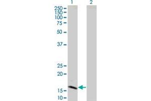 Western Blotting (WB) image for IFNB1 293T Cell Transient Overexpression Lysate(Denatured) (ABIN1332285)