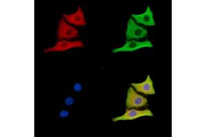 ABIN7096618 and ABIN7100682 staining HepG2 cells by IF/ICC. (DIS3L 抗体)