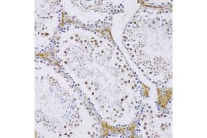 Immunohistochemistry of paraffin-embedded Mouse testis using SRSF3 antibody (ABIN6132649, ABIN6148465, ABIN6148466 and ABIN6221693) at dilution of 1:100 (20x lens). (SRSF3 抗体  (AA 1-90))