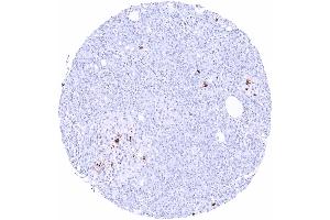 Pancreas Strong somatostatin positivity of a subset of pancreatic islet cells (Recombinant Somatostatin 抗体)