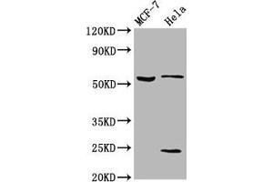 Western Blot Positive WB detected in: MCF-7 whole cell lysate, Hela whole cell lysate All lanes: SLC45A2 antibody at 5. (SLC45A2 抗体  (AA 1-46))