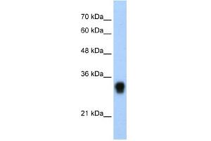 WB Suggested Anti-RPL8 Antibody Titration:  0. (RPL8 抗体  (C-Term))