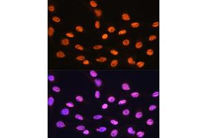 Immunofluorescence analysis of C6 cells using hnRNP K Rabbit mAb (ABIN7267634) at dilution of 1:100 (40x lens). (HNRNPK 抗体)