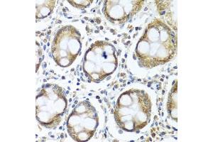 Immunohistochemistry of paraffin-embedded human colon using IFI44 antibody (ABIN6135120, ABIN6142168, ABIN6142169 and ABIN6224213) at dilution of 1:100 (40x lens). (IFI44 抗体)