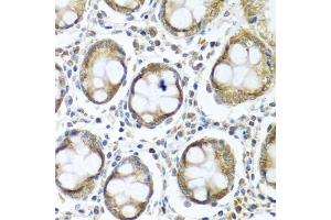 Immunohistochemistry of paraffin-embedded human colon using IFI44 antibody (ABIN6135120, ABIN6142168, ABIN6142169 and ABIN6224213) at dilution of 1:100 (40x lens). (IFI44 抗体)