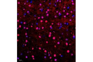 Immunofluorescence of paraffin embedded mouse brain using Api5 (ABIN7073094) at dilution of 1:400 (400x lens) (Apoptosis Inhibitor 5 抗体)
