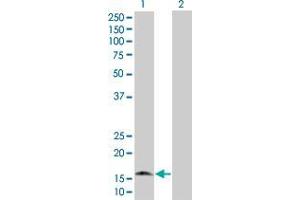 Lane 1: G0S2 transfected lysate ( 11. (G0S2 293T Cell Transient Overexpression Lysate(Denatured))