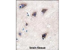 Immunohistochemistry (Paraffin-embedded Sections) (IHC (p)) image for anti-Cytochrome P450, Family 2, Subfamily R, Polypeptide 1 (CYP2R1) (AA 464-496), (C-Term) antibody (ABIN392379)