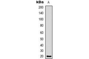 Western blot analysis of CMTM8 expression in Hela (A) whole cell lysates. (CMTM8 抗体)
