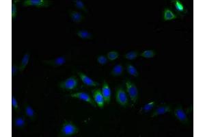 Immunofluorescent analysis of HepG2 cells using ABIN7175622 at dilution of 1:100 and Alexa Fluor 488-congugated AffiniPure Goat Anti-Rabbit IgG(H+L) (LRRC8E 抗体  (AA 353-630))