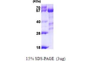 SDS-PAGE (SDS) image for Protein Phosphatase 3, Catalytic Subunit, alpha Isoform (PPP3CA) (AA 1-511) protein (His tag) (ABIN6386673) (PPP3CA Protein (AA 1-511) (His tag))