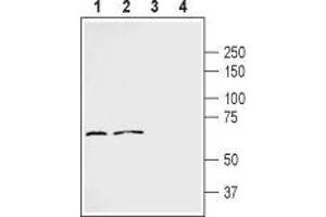 Western blot analysis of human MDA-231 breast carcinoma cell line lysate (lanes 1 and 3) and human THP-1 acute monocytic leukemia cell line lysate (lanes 2 and 4): - 1,2. (FZD2 抗体  (Extracellular))