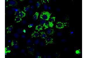 Anti-ACO2 mouse monoclonal antibody (ABIN2452695) immunofluorescent staining of COS7 cells transiently transfected by pCMV6-ENTRY ACO2 (RC204307). (ACO2 抗体)