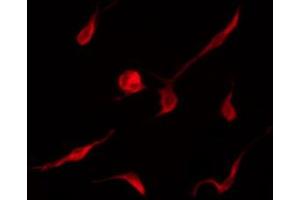 ABIN6267462 staining K562 by IF/ICC. (Cyclin D3 抗体  (pThr283))