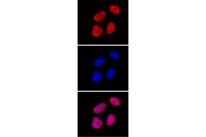 Histone H3 di/trimethyl Lys27 antibody (mAb) tested by immunofluorescence. (Histone 3 抗体  (H3K27me2, H3K27me3))