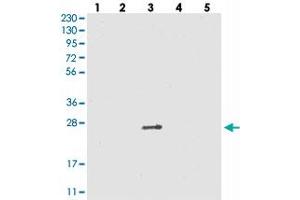 Western blot analysis of Lane 1: RT-4, Lane 2: U-251 MG, Lane 3: Human Plasma, Lane 4: Liver, Lane 5: Tonsil with VSTM2A polyclonal antibody . (VSTM2A 抗体)