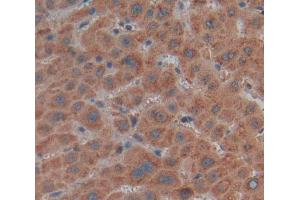 Used in DAB staining on fromalin fixed paraffin- embedded Kidney tissue (MMP21 抗体  (AA 335-547))