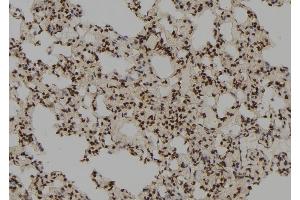 ABIN6264710 and ABIN6278515 at 1/100 staining Rat lung tissue by IHC-P.