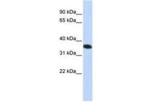 Image no. 1 for anti-Chromosome 21 Open Reading Frame 59 (C21orf59) (N-Term) antibody (ABIN6740941) (C21orf59 抗体  (N-Term))