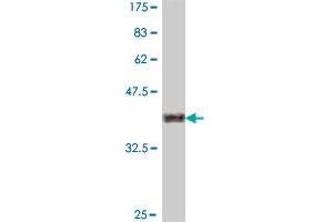 Western Blot detection against Immunogen (37. (Granulin 抗体  (AA 494-593))
