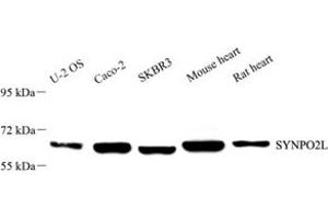 Western blot analysis of SYNPO2L (ABIN7075791) at dilution of 1: 2000 (SYNPO2L 抗体)
