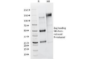 SDS-PAGE Analysis Purified FSH Receptor Mouse Monoclonal Antibody (FSHR/1400). (FSHR 抗体)