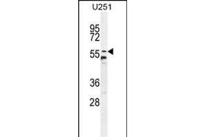 CCDC9 Antibody (N-term) (ABIN654741 and ABIN2844427) western blot analysis in  cell line lysates (35 μg/lane). (CCDC9 抗体  (N-Term))