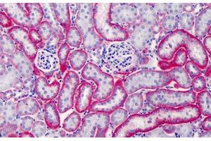 Mouse Kidney: Formalin-Fixed, Paraffin-Embedded (FFPE) (CD147 抗体)
