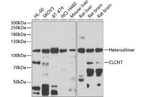 Western blot analysis of extracts of various cell lines, using CLCN7 antibody (ABIN6133268, ABIN6138670, ABIN6138672 and ABIN6222613) at 1:1000 dilution. (CLCN7 抗体  (AA 626-805))