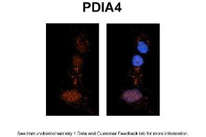 Sample Type: NT2 cells Red: Antibody Blue: DAPI Primary Dilution: 1ug/50ul antibody Secondary Antibody: Alexa goat anti-rabbit 594 Image Submitted by: Yuzhi Chen, University of Arkansas for Medical Sciences (PDIA4 抗体  (N-Term))