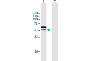 Western Blot analysis of C1orf124 expression in transfected 293T cell line by C1orf124 MaxPab polyclonal antibody. (Spartan 抗体  (AA 1-489))