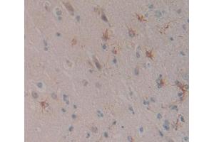 Immunohistochemistry (IHC) image for anti-serpin Peptidase Inhibitor, Clade I (neuroserpin), Member 1 (SERPINI1) (AA 17-410) antibody (ABIN1869555)