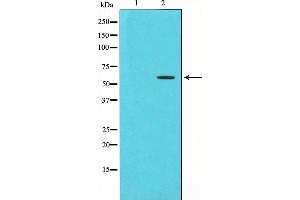 Western blot analysis of Chk1 phosphorylation expression in UV treated HT29 whole cell lysates,The lane on the left is treated with the antigen-specific peptide. (CHEK1 抗体  (pSer280))