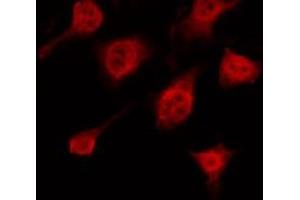 ABIN6266577 staining HeLa by IF/ICC. (Keratin 10 抗体  (Internal Region))