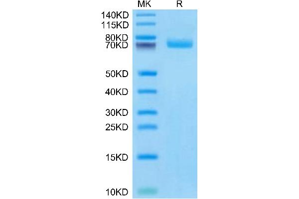 VSIG4 Protein (AA 25-288) (His tag)