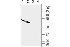 Western blot analysis of human U-87 MG glioblastoma cell line lysate (lanes 1 and 3) and human Malme-3M melanoma cell line lysate (lanes 2 and 4): - 1,2. (TNFRSF19 抗体  (Extracellular, N-Term))