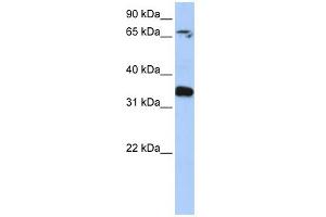 WB Suggested Anti-GLE1 Antibody Titration: 0. (GLE1 抗体  (N-Term))
