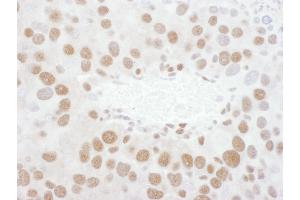 Immunohistochemistry (IHC) image for anti-TAR DNA Binding Protein (TARDBP) (AA 150-200) antibody (ABIN7454905) (TARDBP 抗体  (AA 150-200))