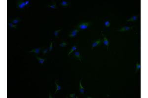 Immunofluorescence staining of Hela cells with ABIN7147892 at 1:100, counter-stained with DAPI. (Claudin 18 抗体  (AA 196-261))