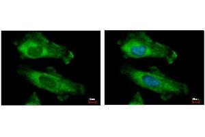 ICC/IF Image RPS10 antibody detects RPS10 protein at cytoplasm by immunofluorescent analysis. (RPS10 抗体)