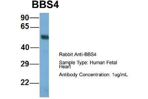 Host: Rabbit  Target Name: BBS4  Sample Tissue: Human Fetal Heart  Antibody Dilution: 1. (BBS4 抗体  (N-Term))